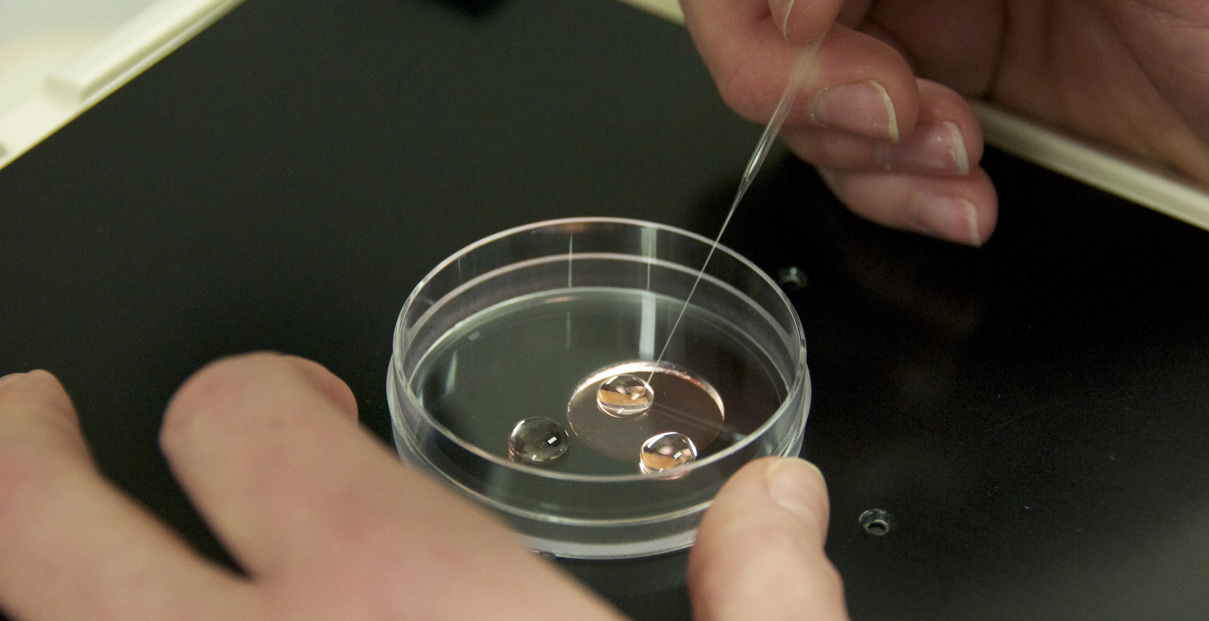 Embryo transfer picture