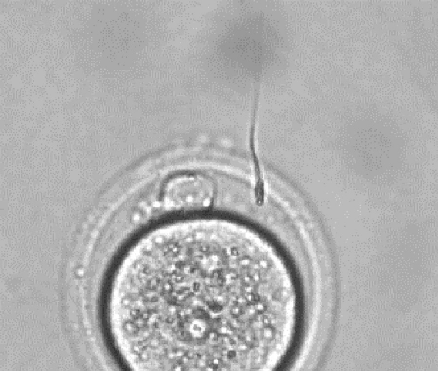 In Vitro Fertilisation (IVF) | Central Transgenic Core | Bioresearch ...