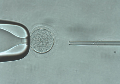 Microinjection through microscope